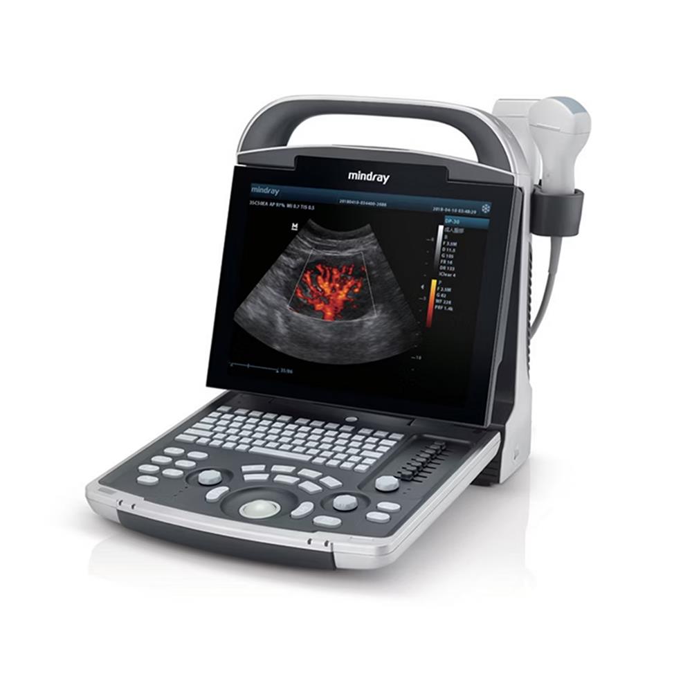 Υπέρηχος έγχρωμος φορητός Mindray DP-30